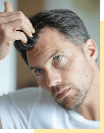 hair-loss-frame