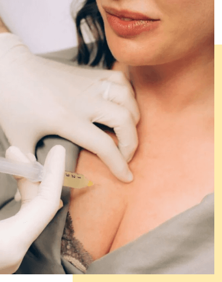 prp-breast