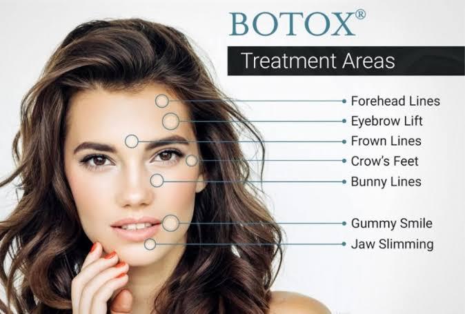 An infographic showing the areas of the skin that receive botox injections and how they help to minimize wrinkles and enhance its attractiveness.