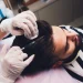 Laser-Assisted Hair Restoration