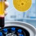 PRP for erectile dysfunction