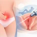 Does Vaginal Laser Tightening Hurt? What to Expect